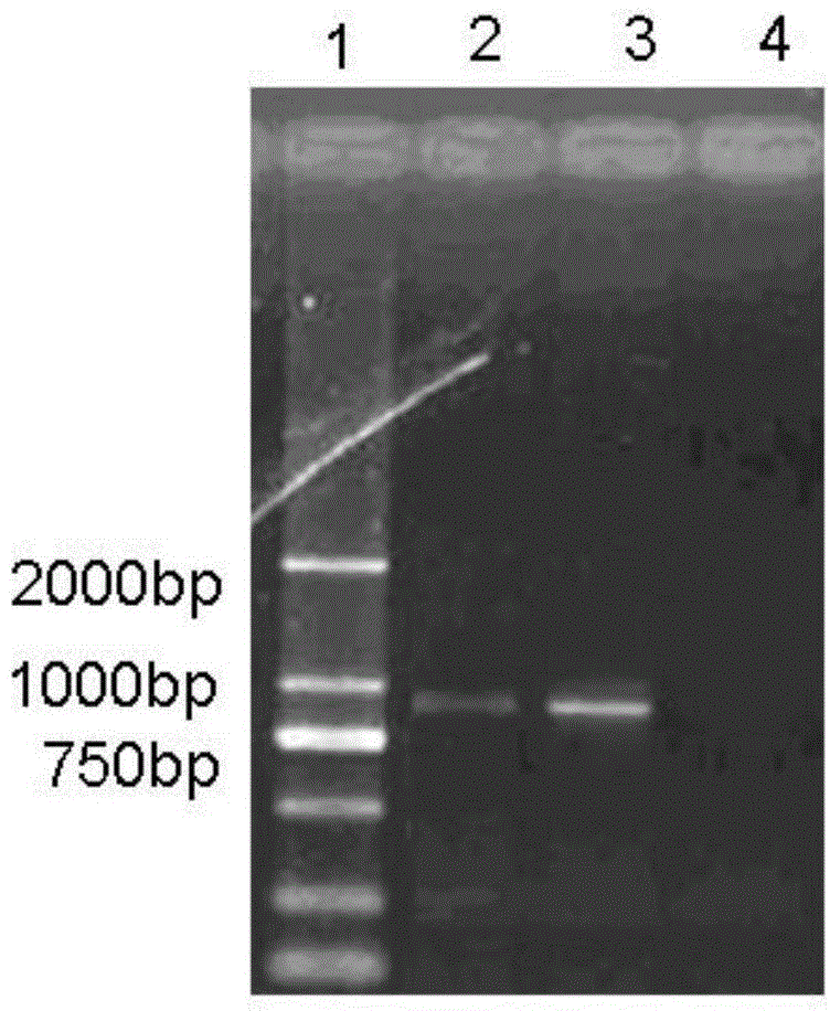 New mycoplasma hyopneumoniae strain and vaccine composite of new mycoplasma hyopneumoniae