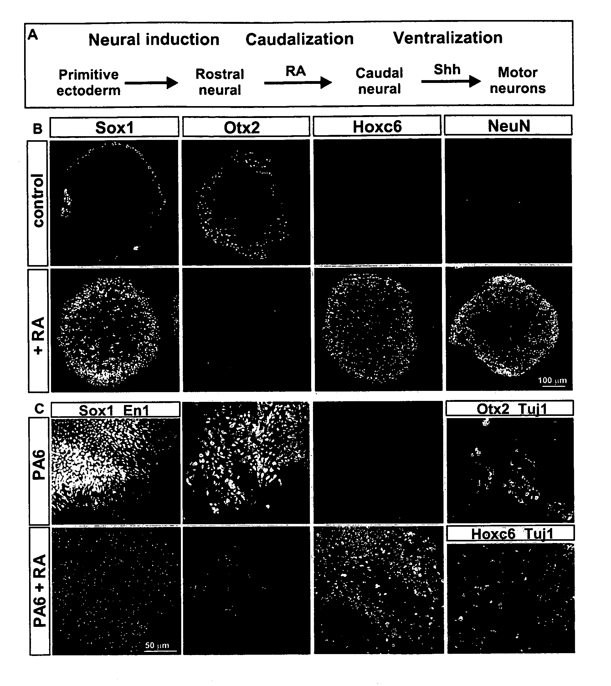 Systems and methods for screening for modulators of neural differentiation