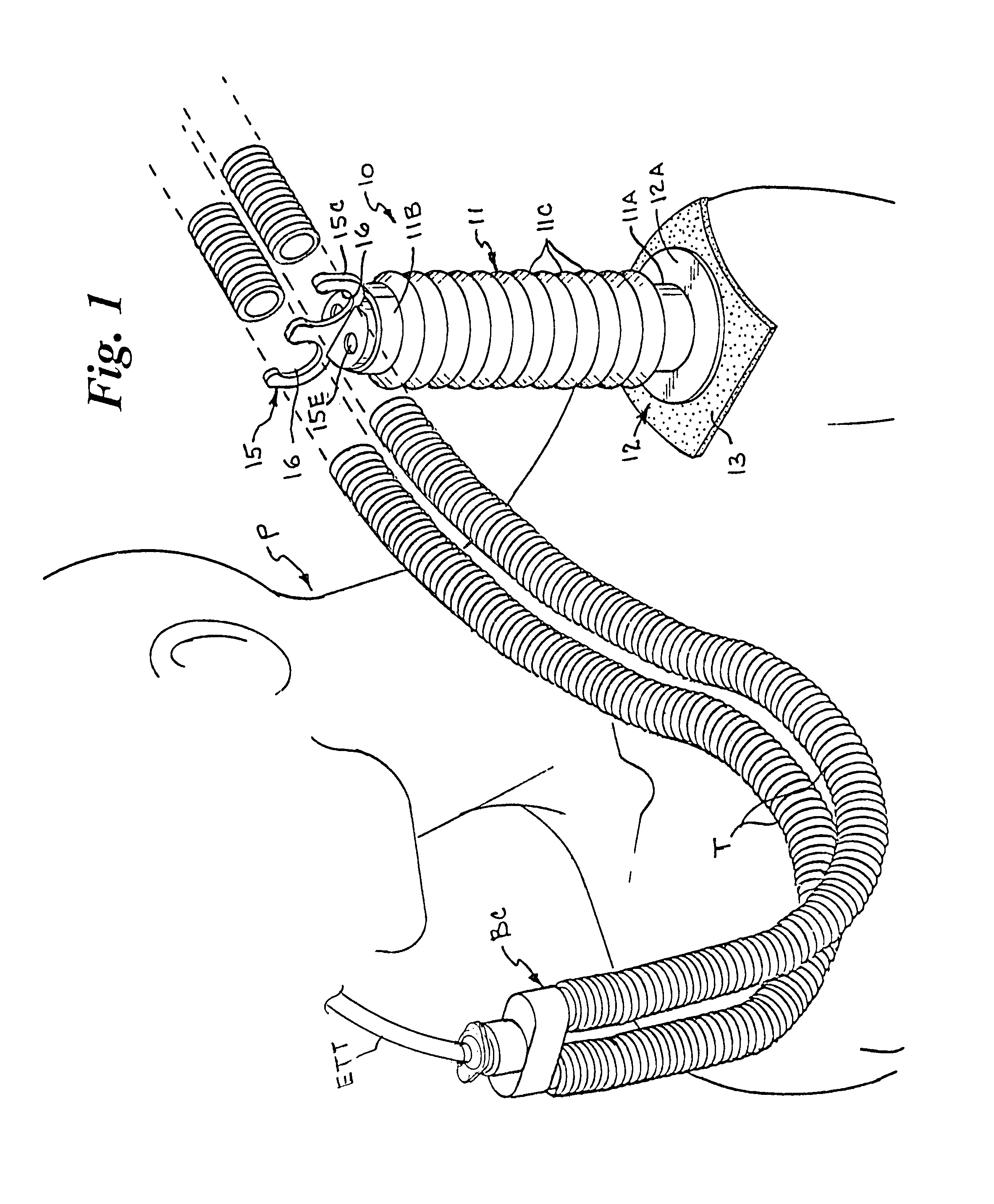 Anesthesia breathing circuit tube support