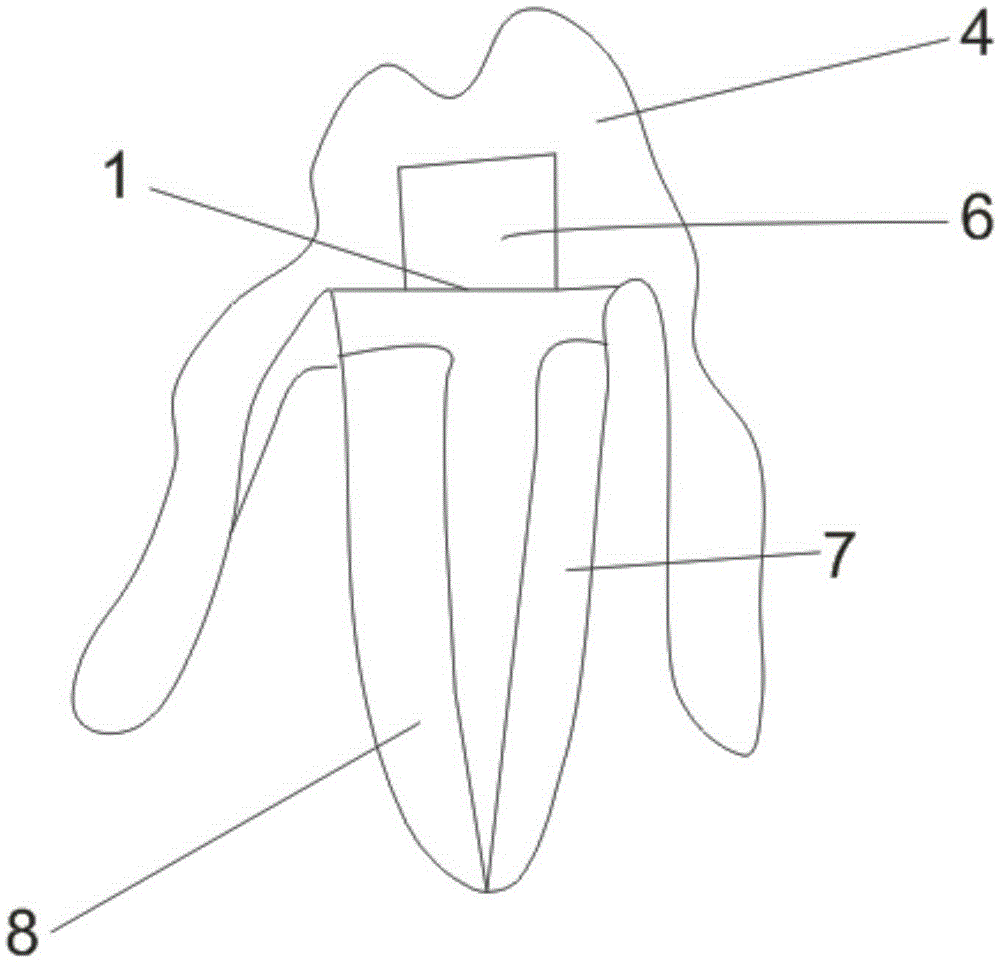 Adsorption force improving complete denture