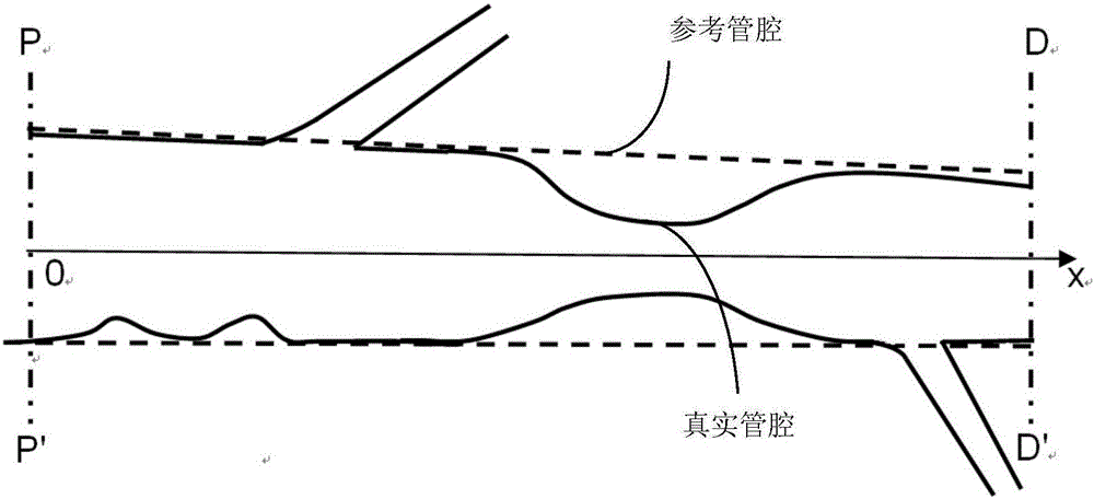 Method and system for rapid calculation of pressure difference of bifurcated vessel and FFR based on CFD simulation