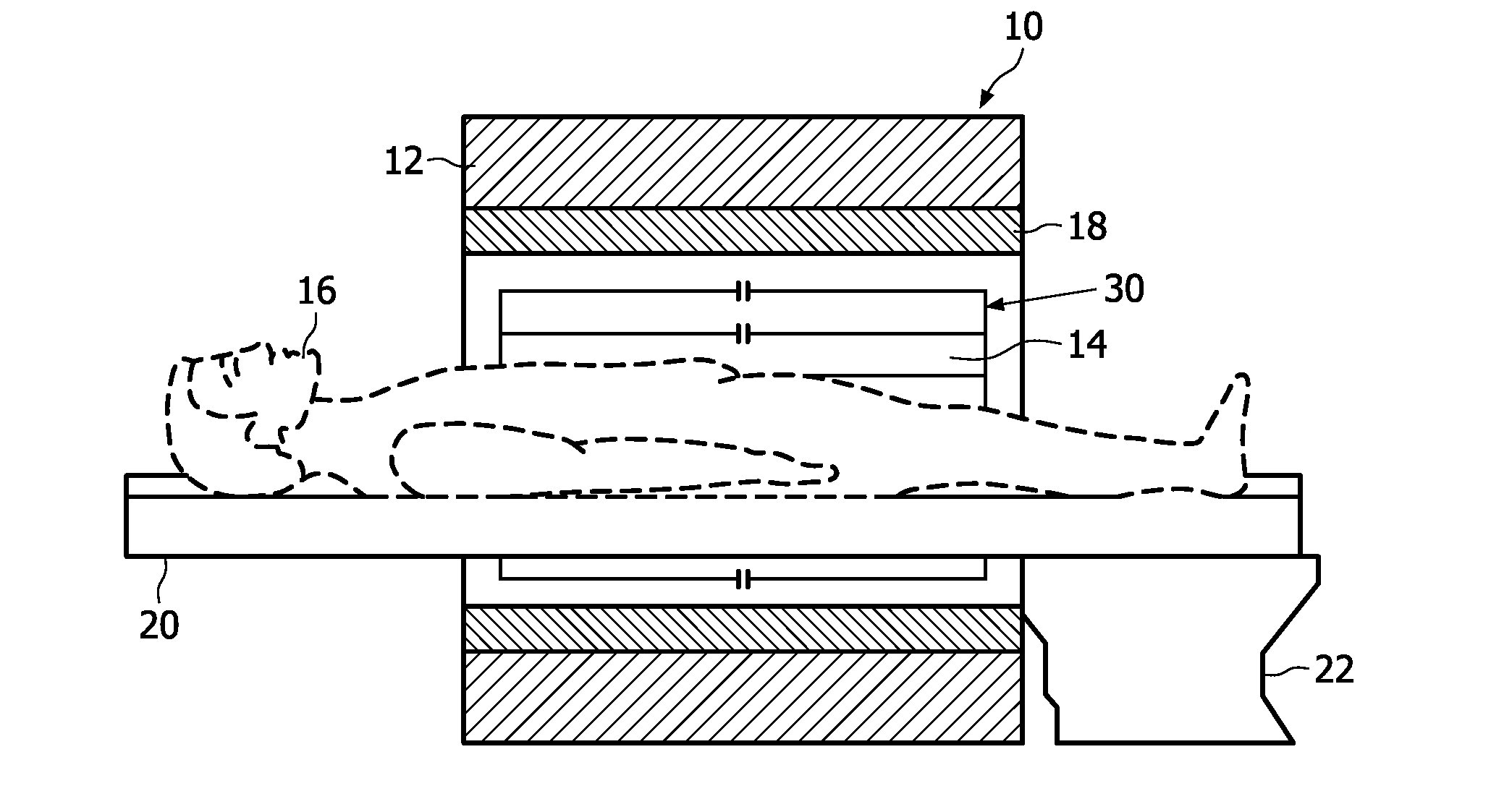 Dual tuned volume coils adapted to provide an end ring mode