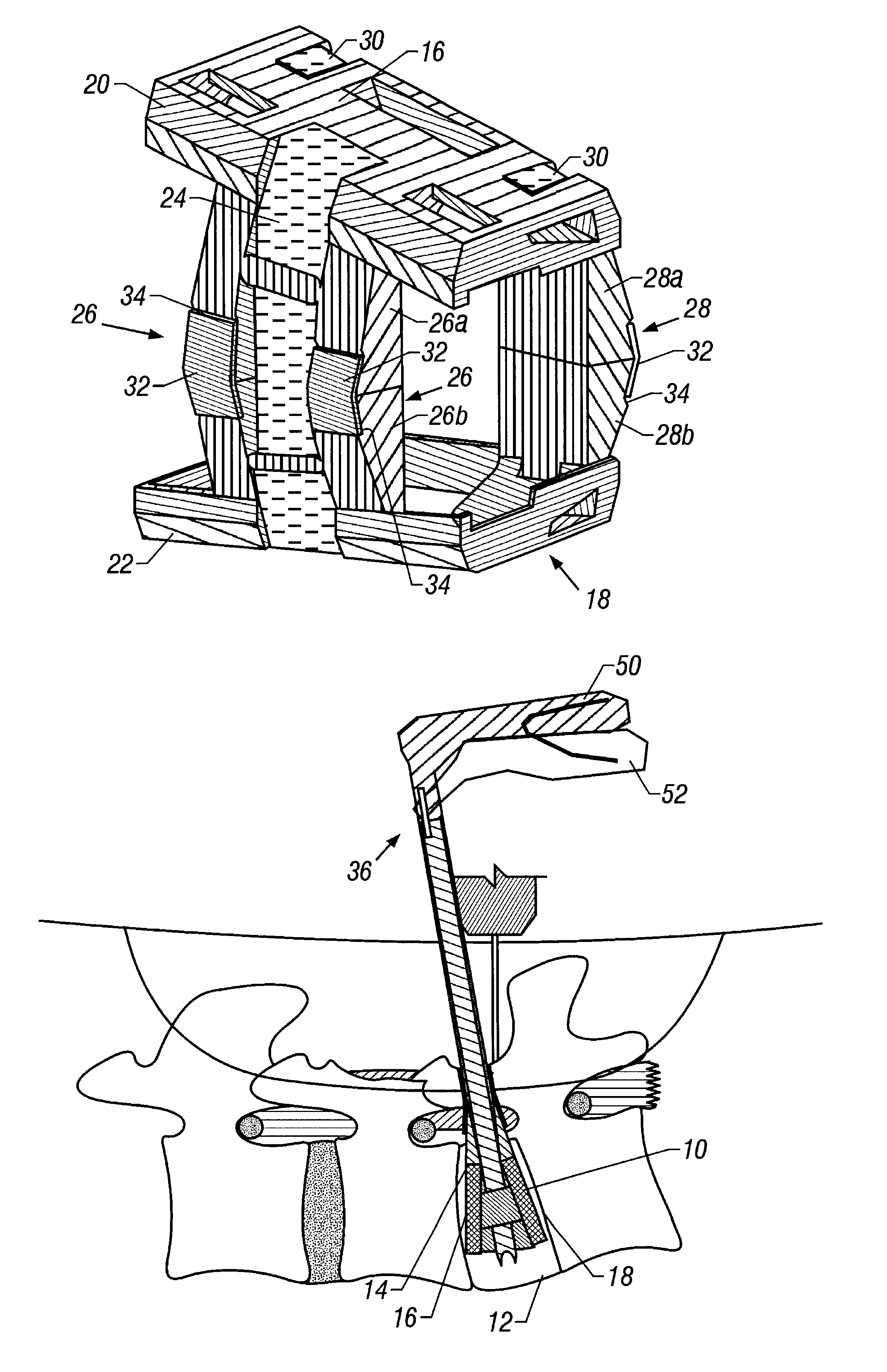 Method and apparatus for providing an expandable spinal fusion cage