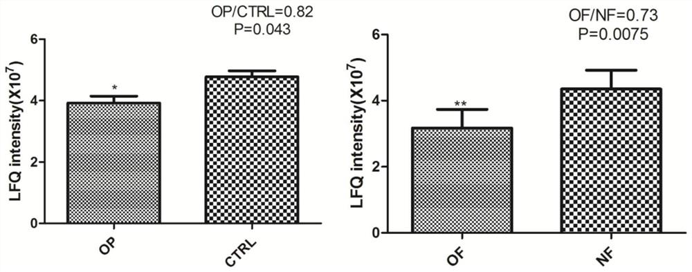 A protein biomarker for the diagnosis of osteoporosis and its application