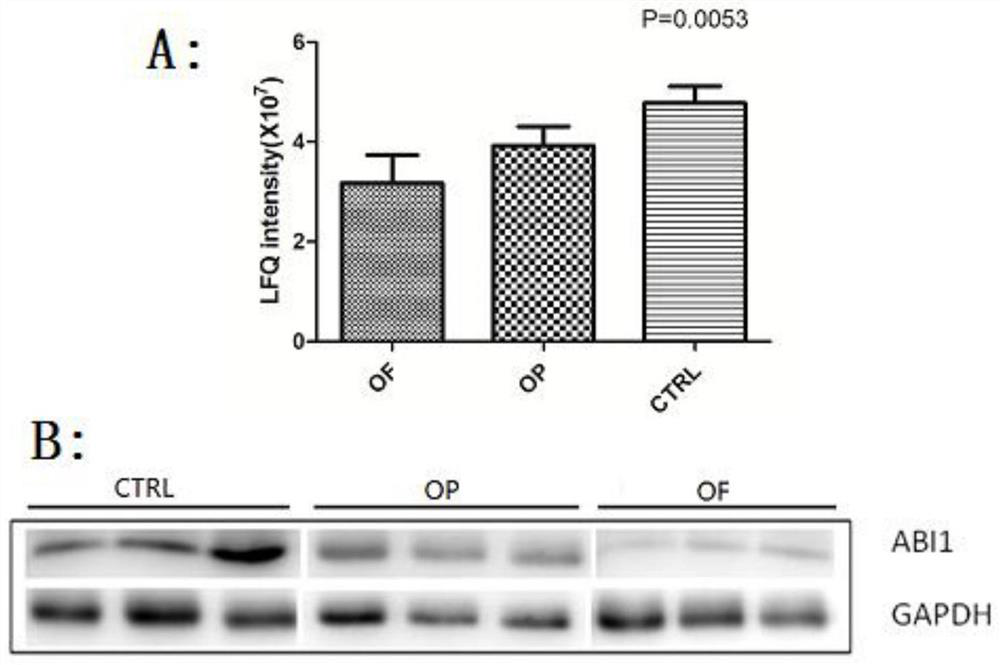 A protein biomarker for the diagnosis of osteoporosis and its application