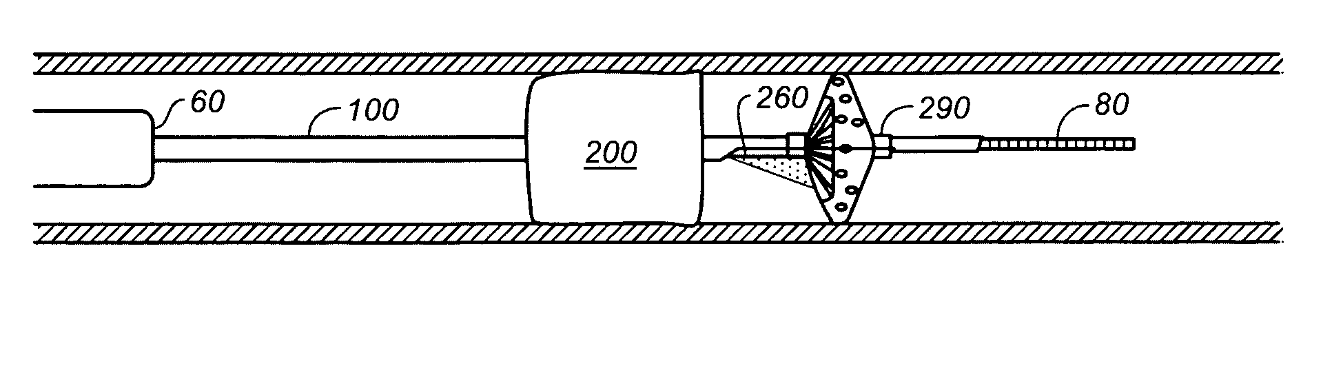 Integrated device for ischemic treatment