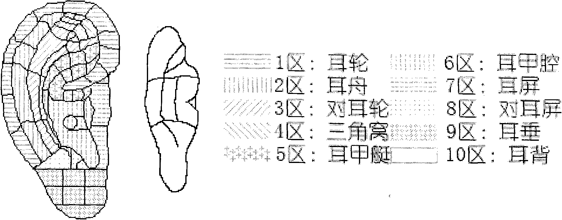 Computer method for realizing auricular point pseudo-color distribution graph