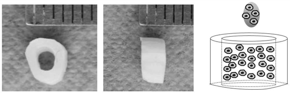 Preparation of exosomes from dental epithelial cells, preparation and application of exosome implants