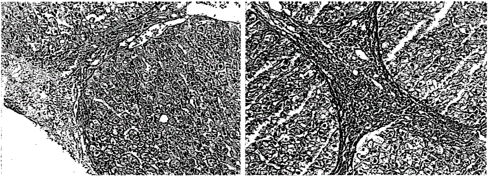 A medicine for regulating liver regeneration and its preparation method