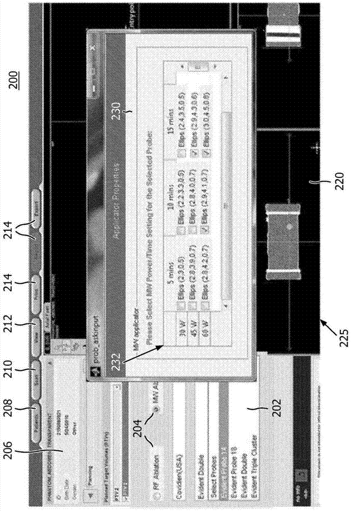 Ablation planning system