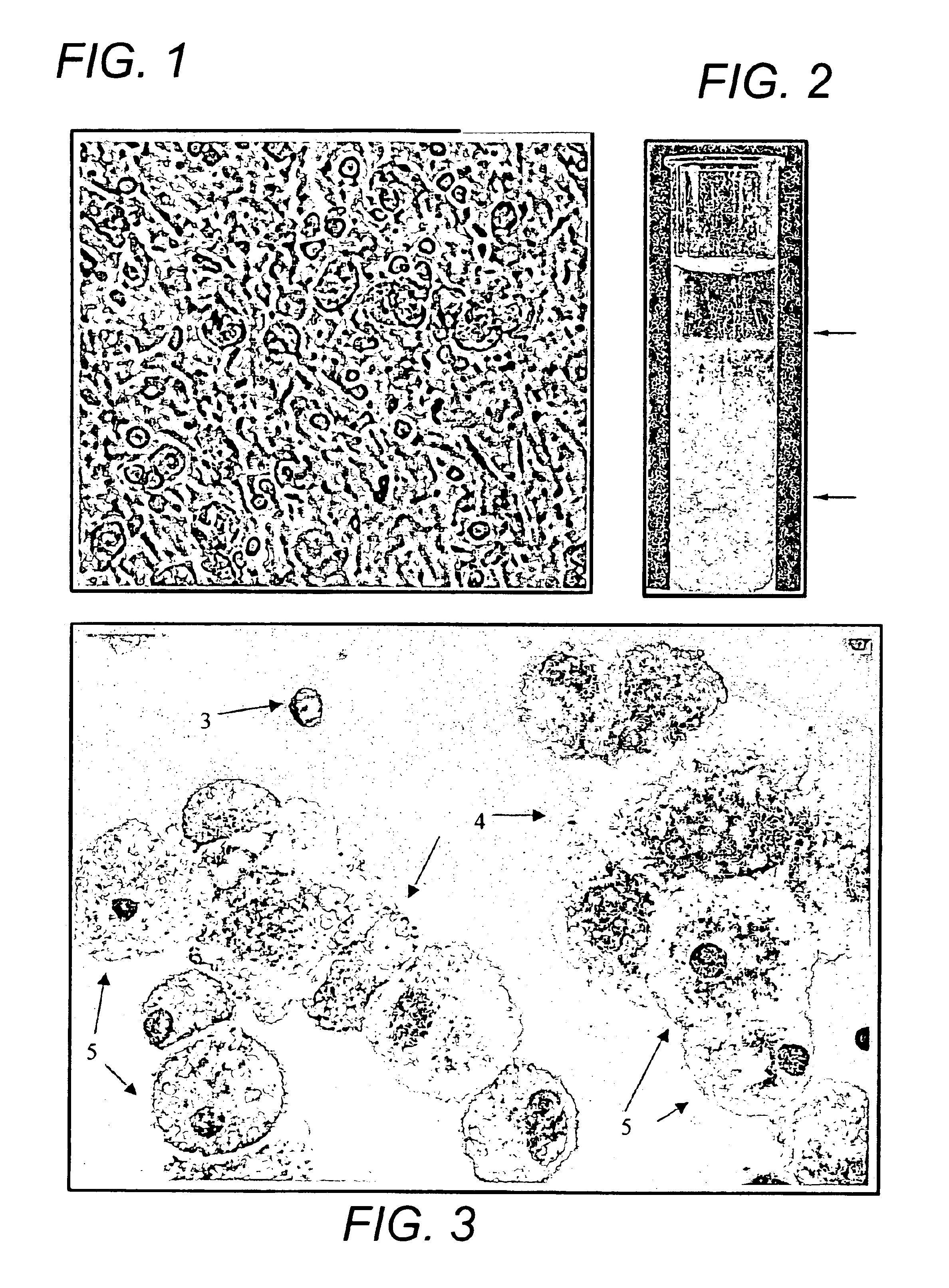 Human mesenchymal progenitor cell