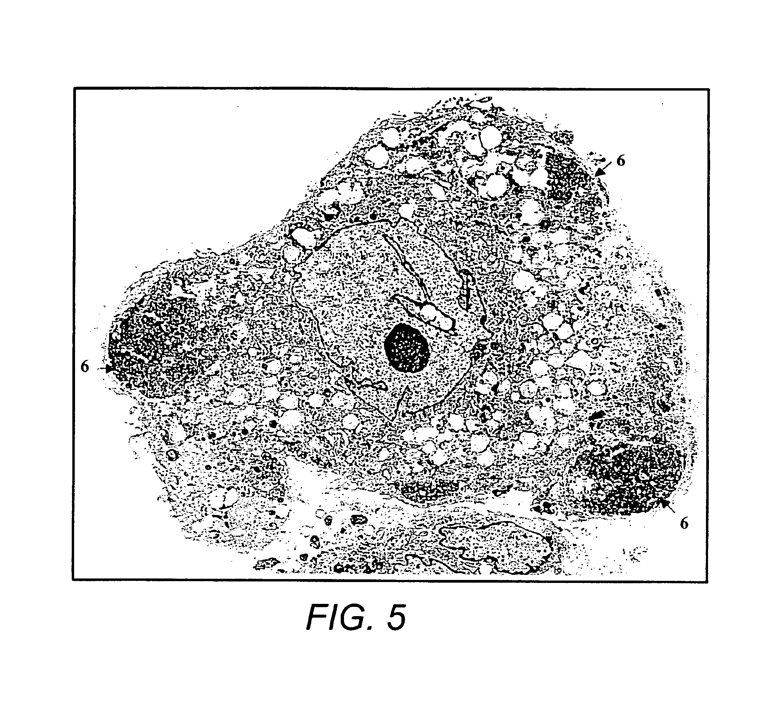 Human mesenchymal progenitor cell