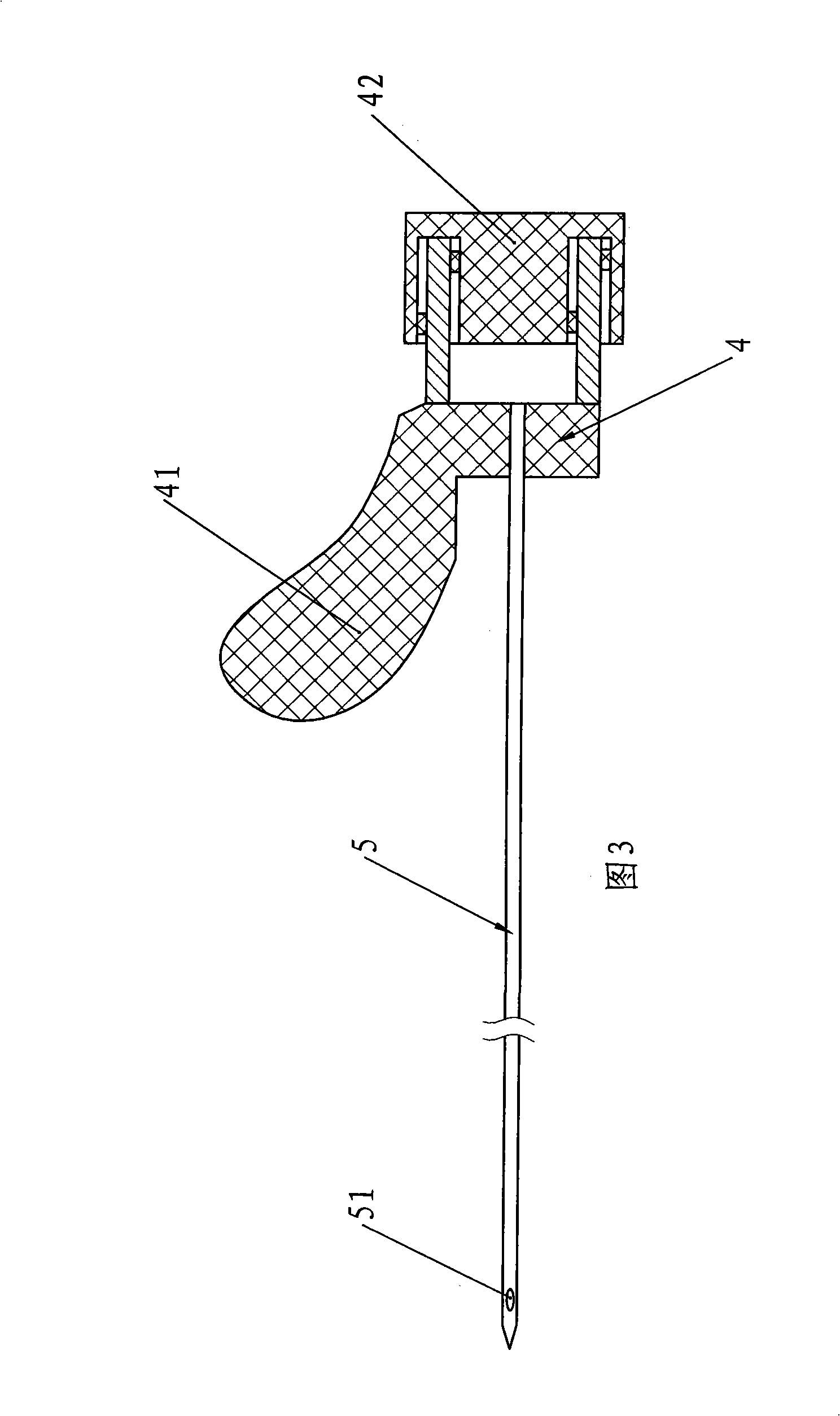 Disposable thoracic drainage needle