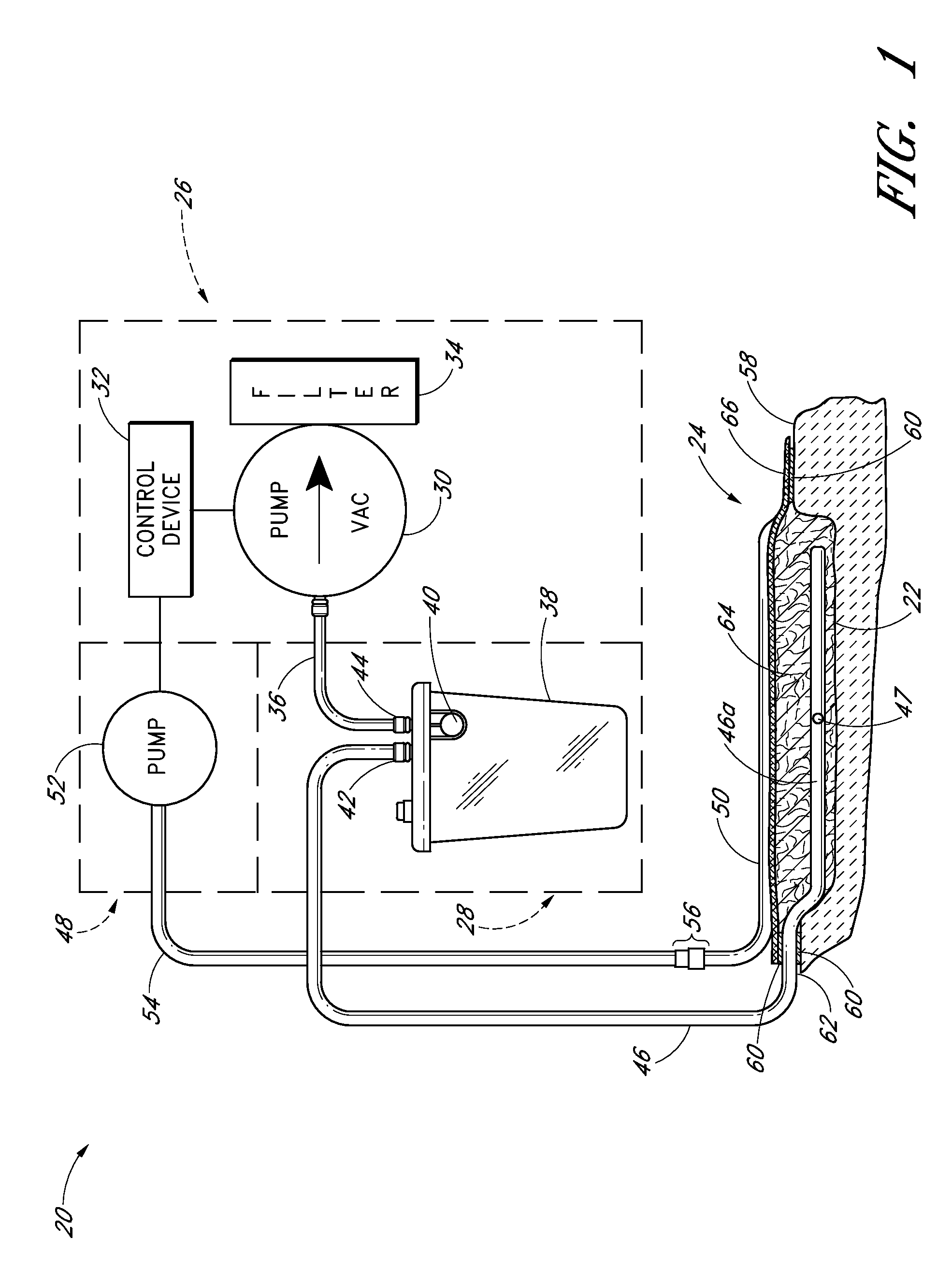 Negative pressure dressing and method of using same