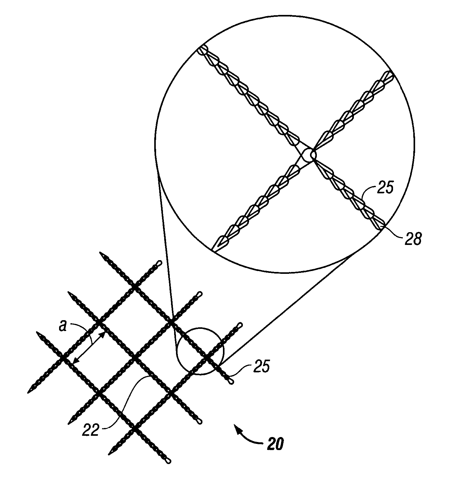 Mesh implant