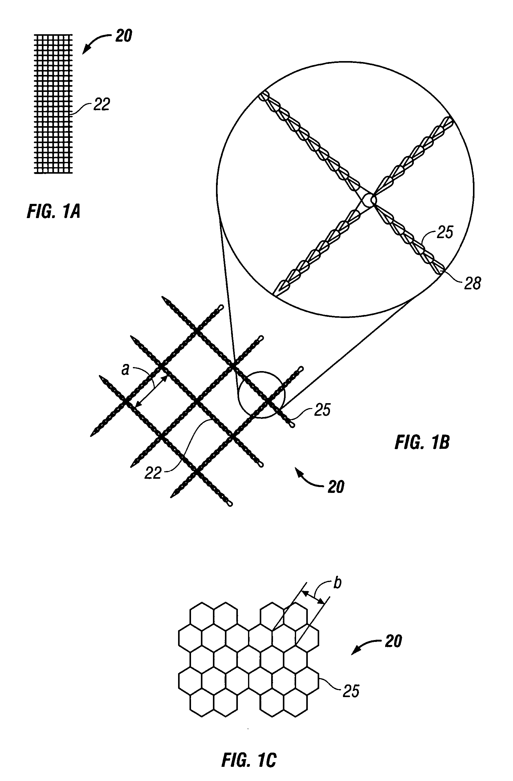 Mesh implant