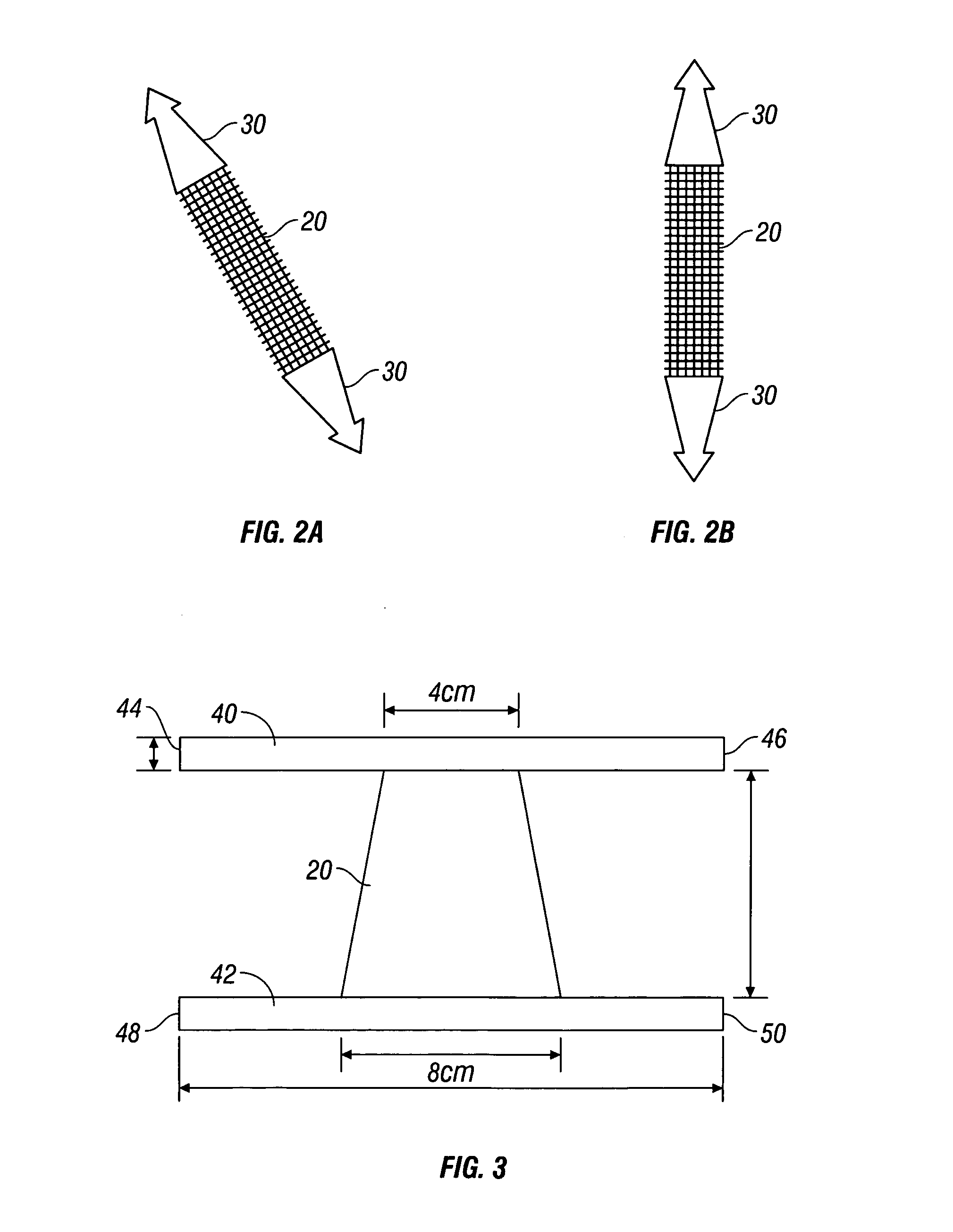 Mesh implant