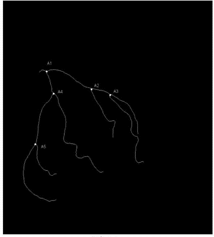 Single-arm x-ray angiography image multiple motion parameter decomposition and estimation method