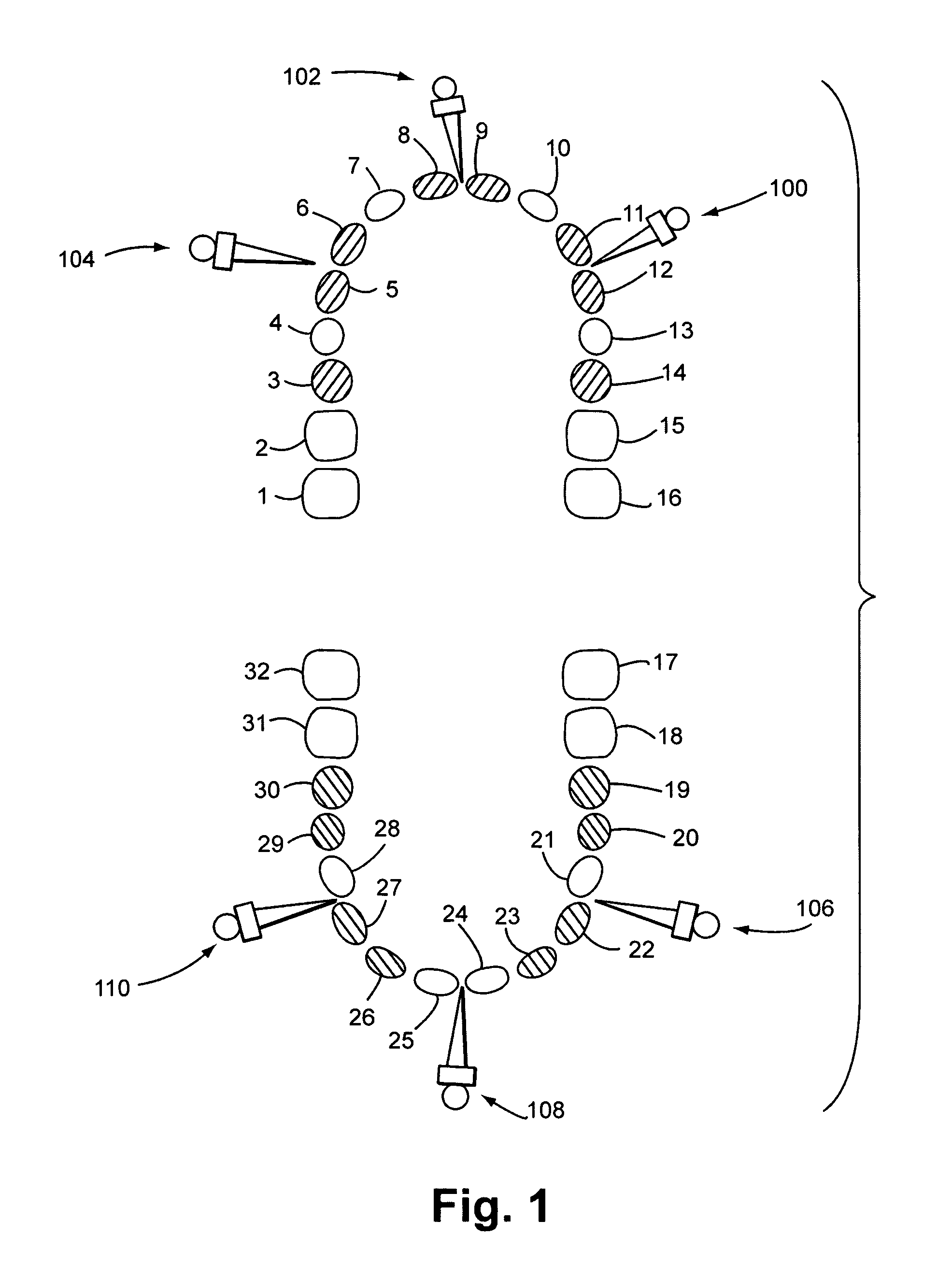 Capture of a planned vertical dimension of occlusion to facilitate simultaneous restoration of both maxillary and mandibular arches using implants