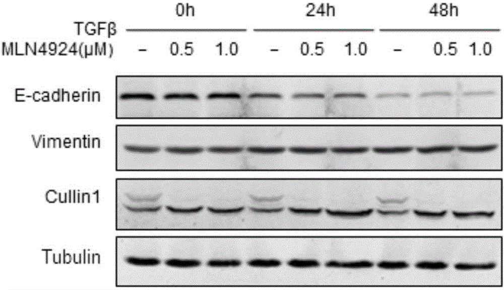 Applications of small-molecular inhibitor MLN4924 in preparation of drug for inhibiting bleomycin-induced pulmonary fibrosis