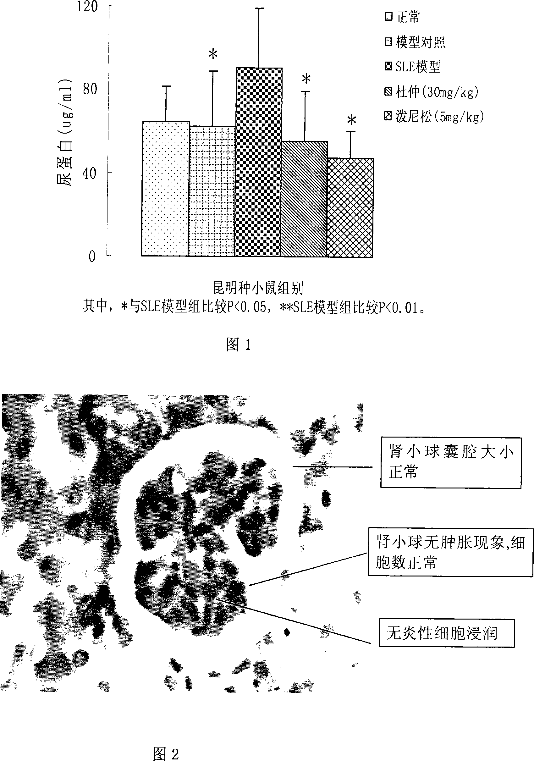 Use of cortex eucommiae total polyoses in the preparing of the medicine for preventing and treating systematic lupus erythematosus