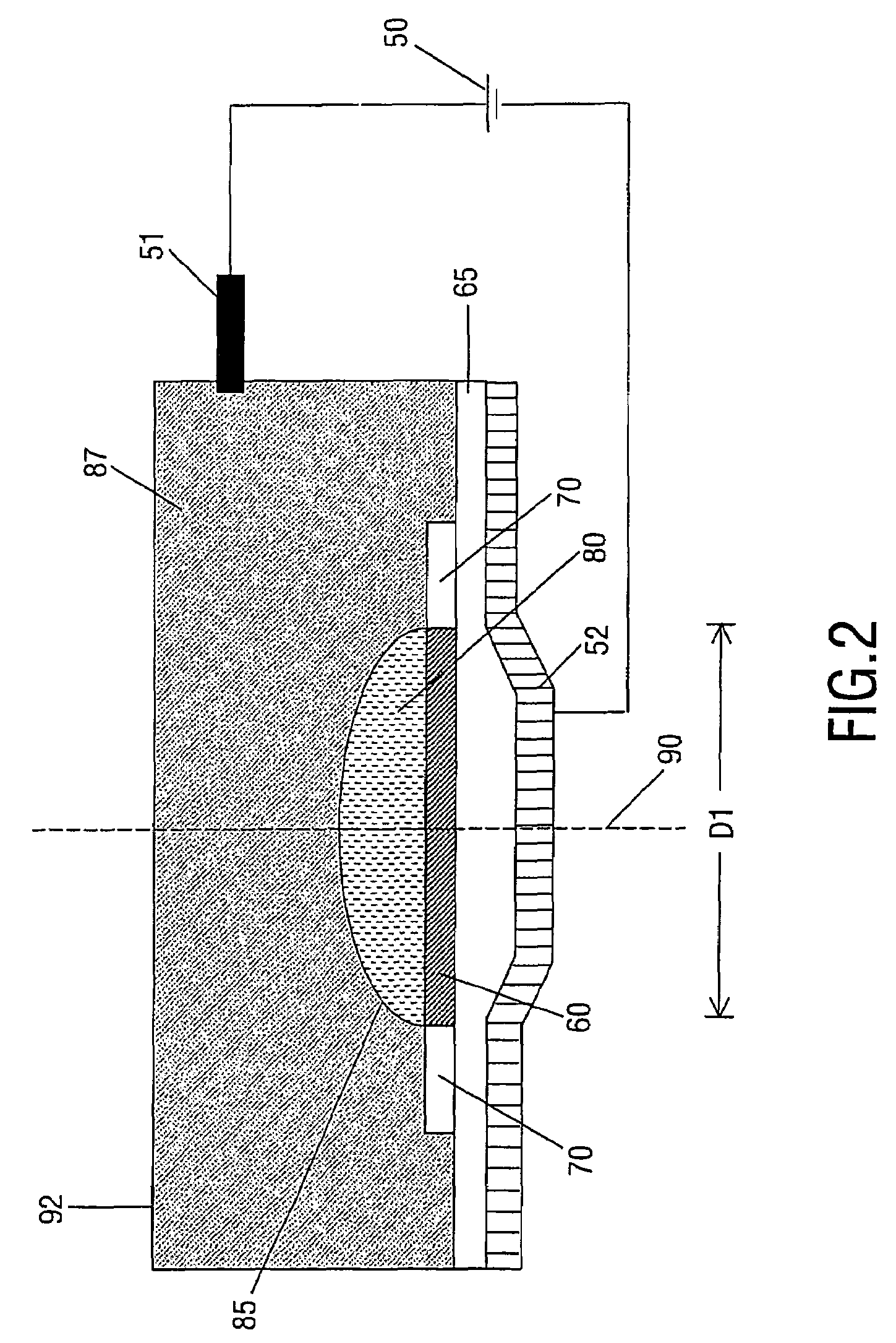 Variable lens