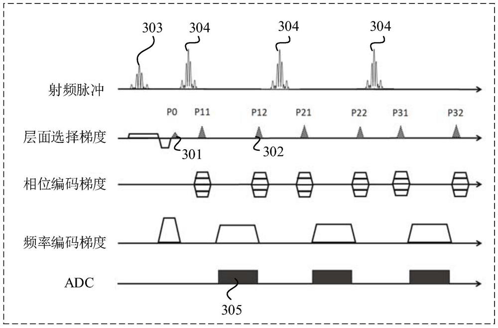 Magnetic resonance black blood imaging method and system