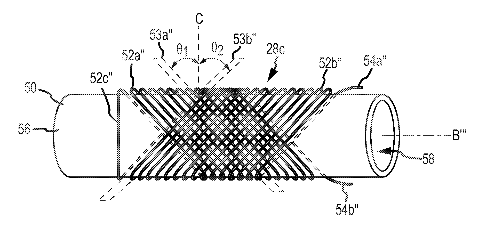 Roll detection and six degrees of freedom sensor assembly