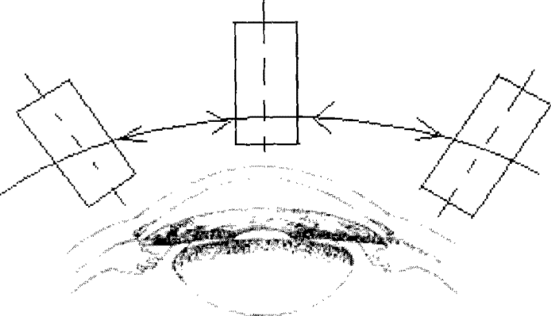 Method for panoramic imaging ophthalmology protomerite detected by ultrasound biological microscopes