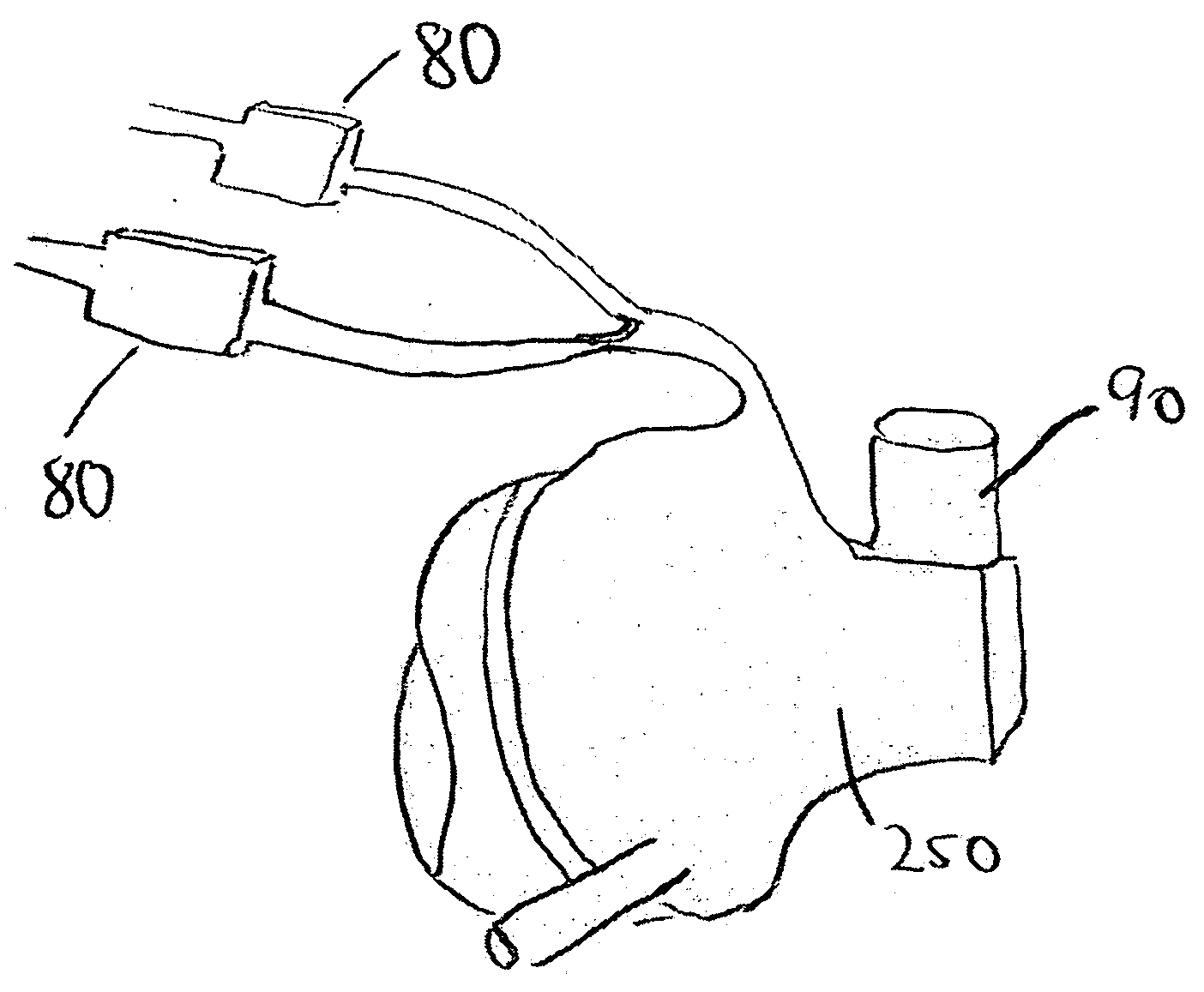 Apparatus for maintaining airway patency