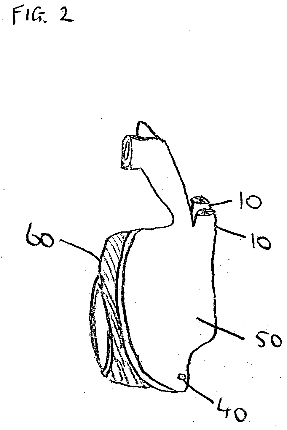 Apparatus for maintaining airway patency