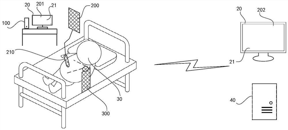 Image processing system and terminal equipment