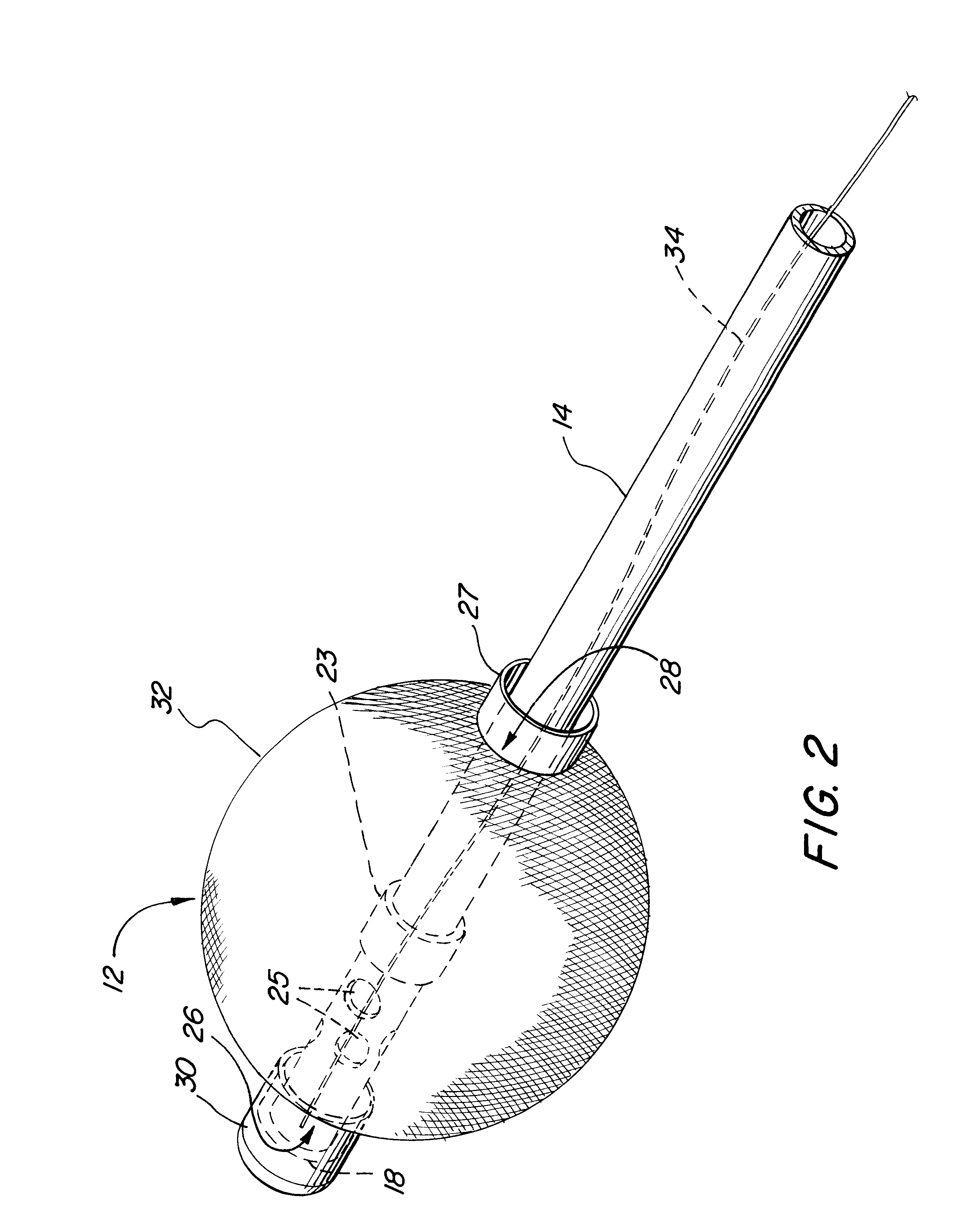 Self-deploying catheter assembly