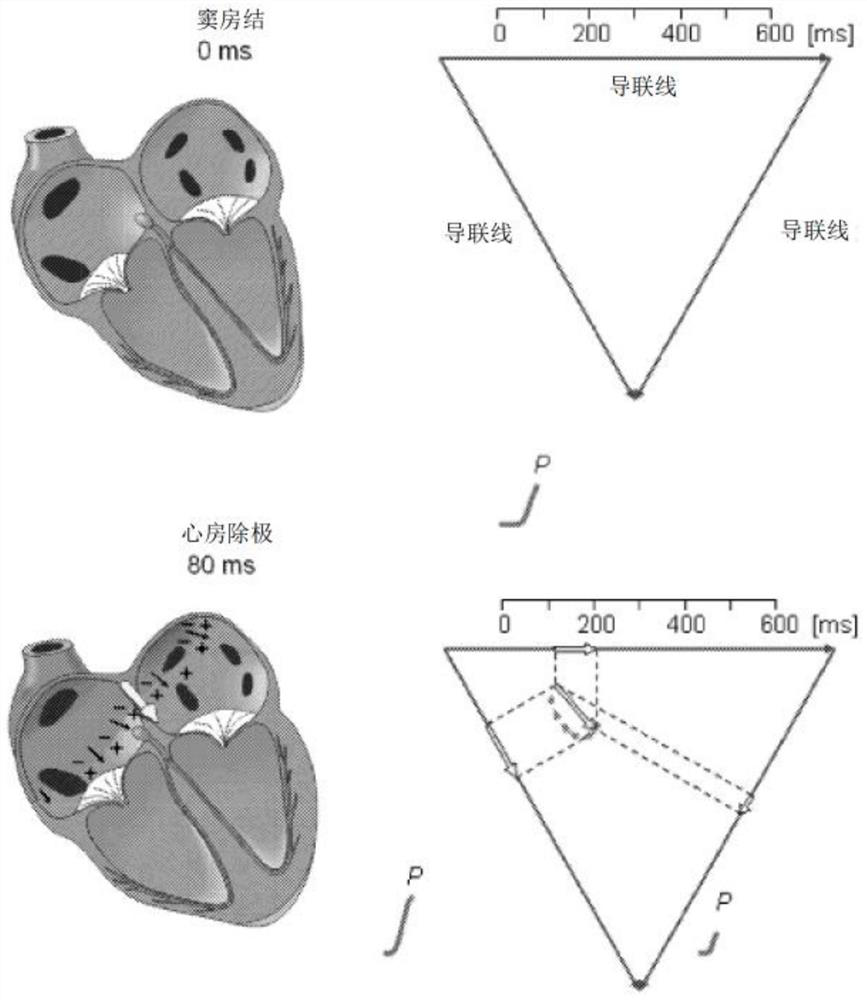 Microelectronic sensors for non-invasive monitoring of physiological parameters