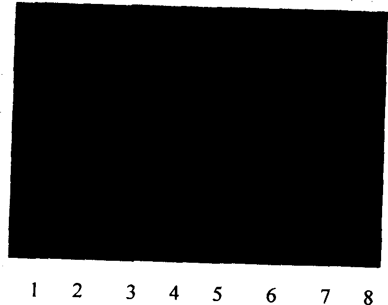 Specific primer sequence of cattle Y-chromosome and its application in cow embryo six identification