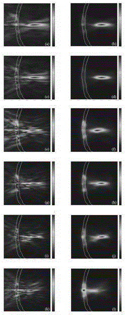 Extracranial standing wave suppression method for high-intensity ultrasound transcranial focusing