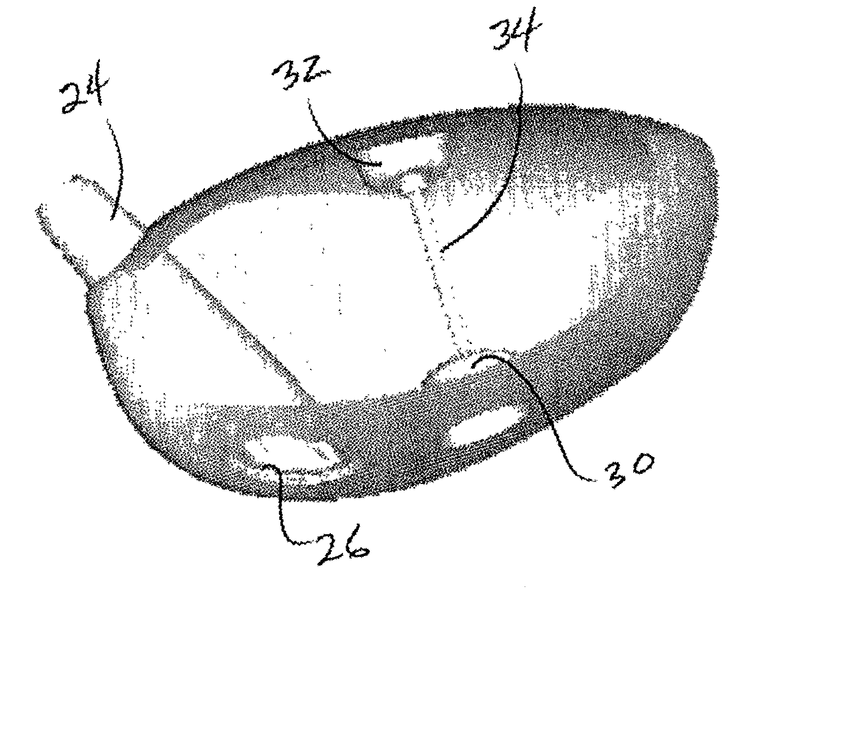 Golf club head having a device for resisting expansion between opposing walls during ball impact