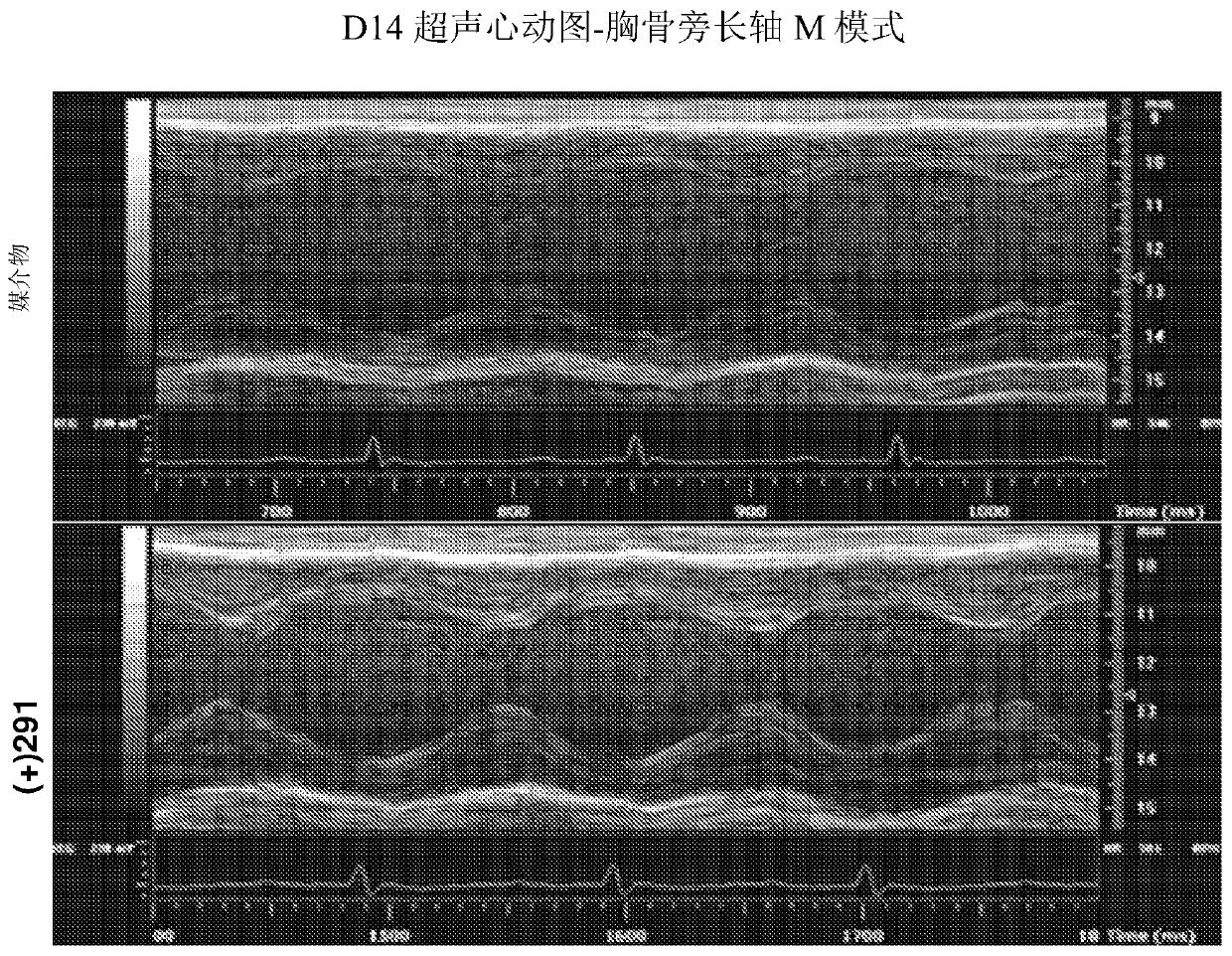 Inhibitors of short-chain dehydrogenase activity for treating coronary disorders