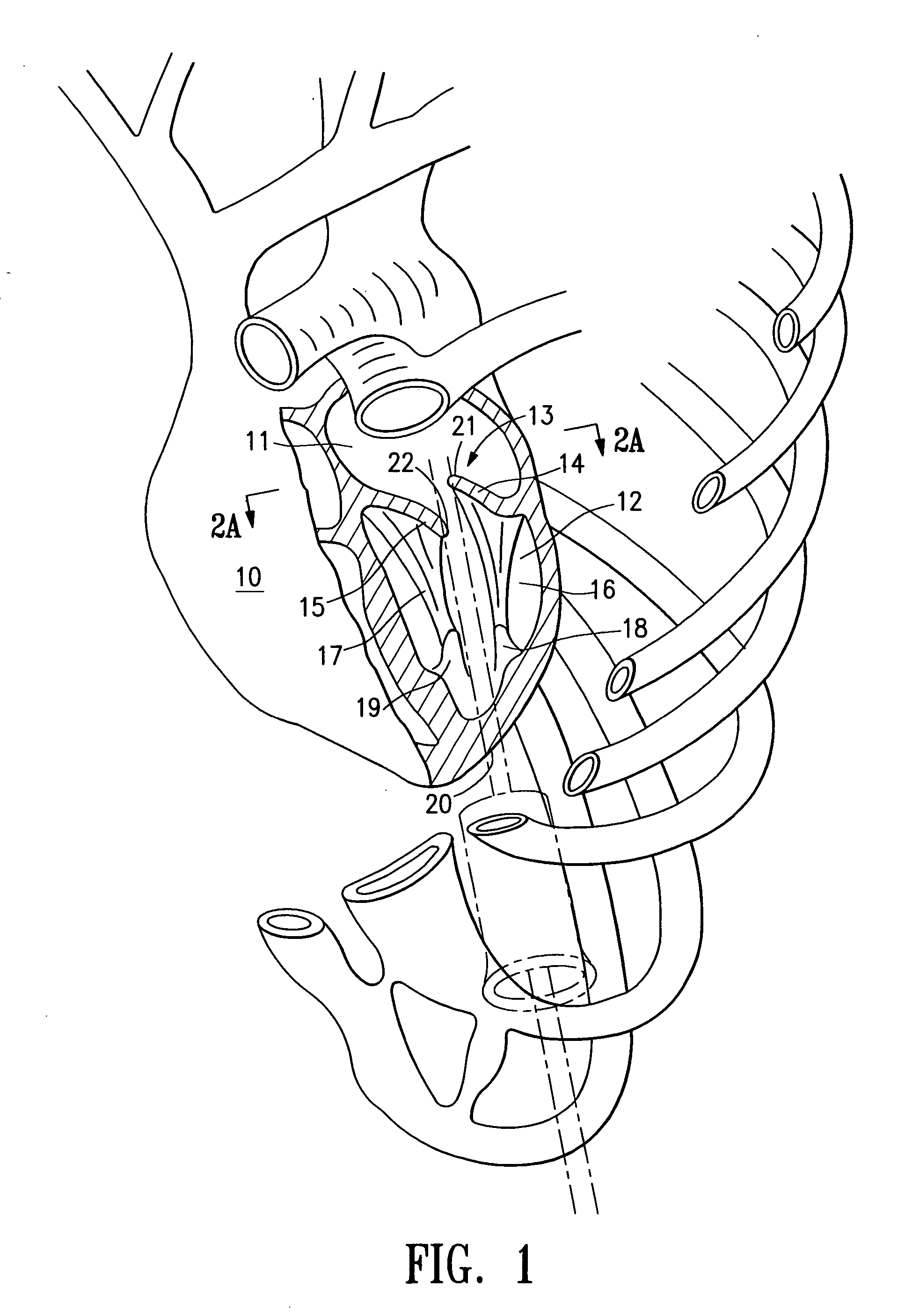 Treatments for a patient with congestive heart failure