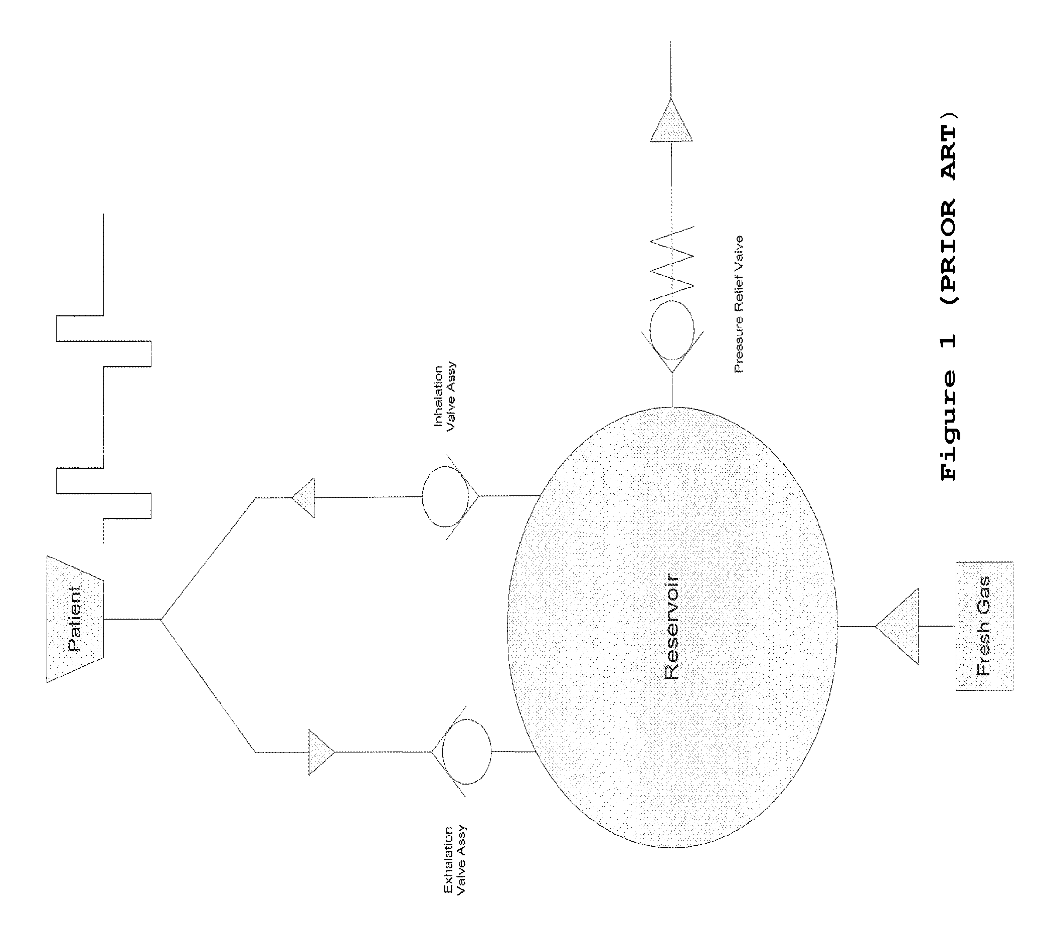 Method and apparatus for facilitating delivery of anaesthetic