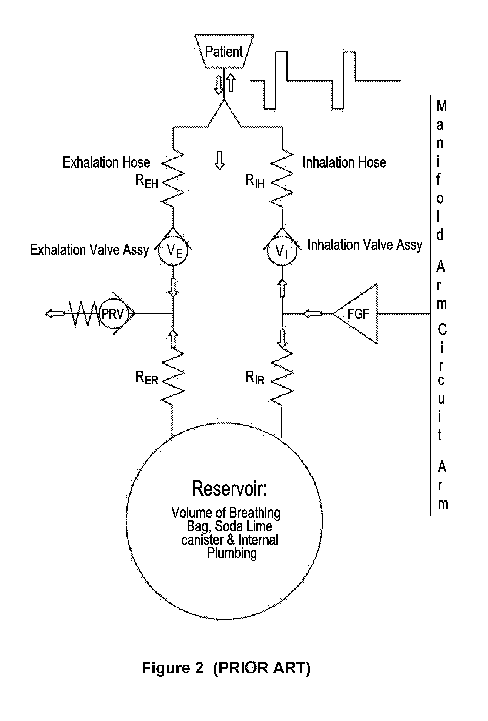 Method and apparatus for facilitating delivery of anaesthetic