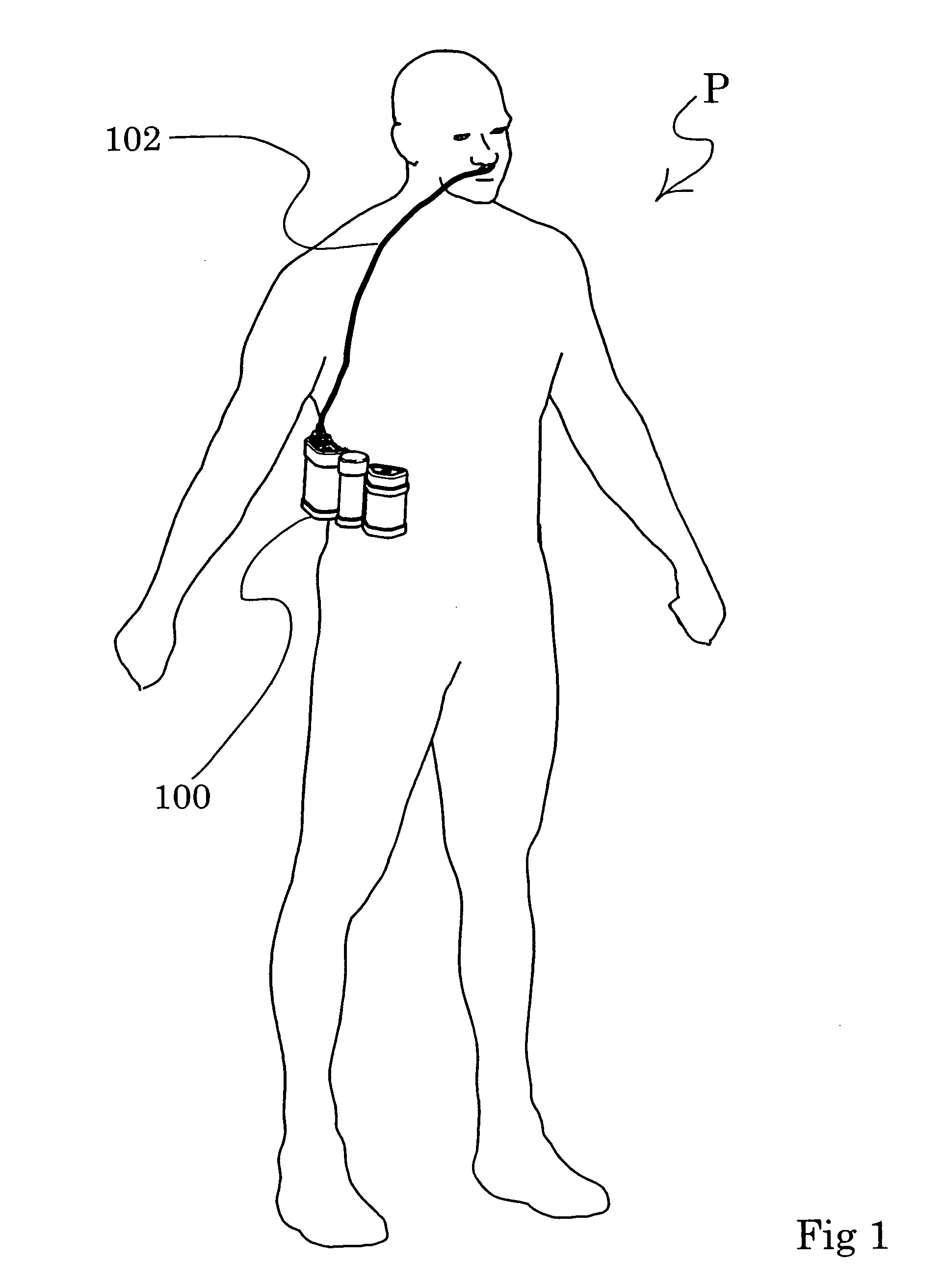 Low power ambulatory oxygen concentrator