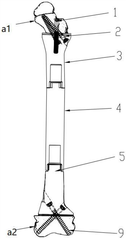 Children type tumor joint prosthesis with reserved femoral neck and knee joint surface