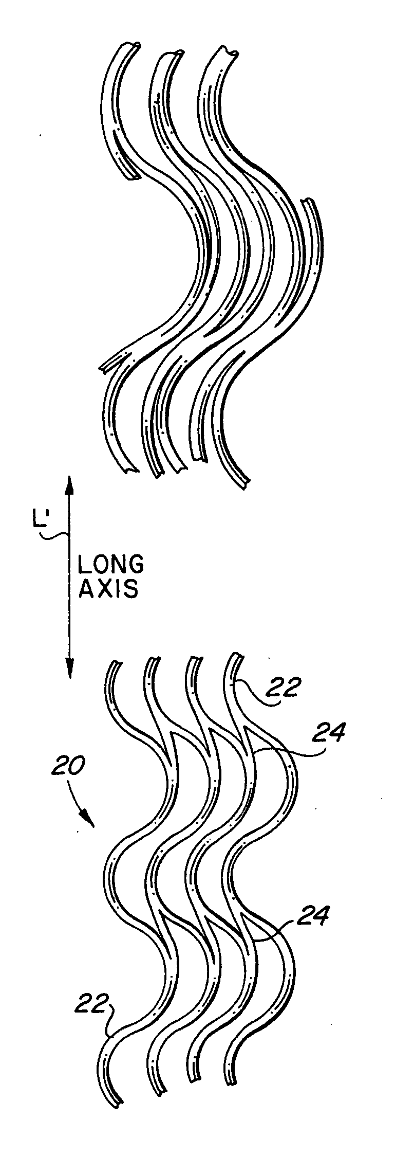 Endoluminal stent, self-supporting endoluminal graft and methods of making same