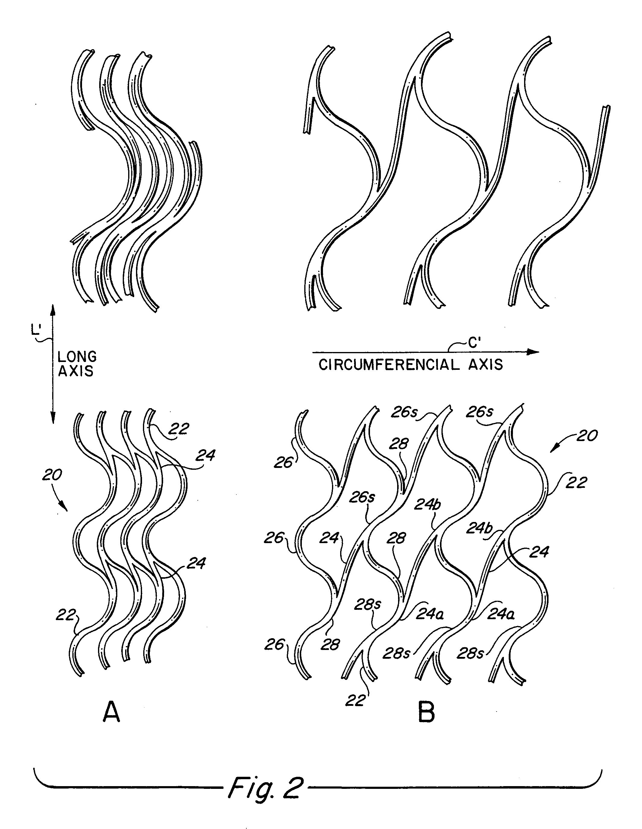 Endoluminal stent, self-supporting endoluminal graft and methods of making same