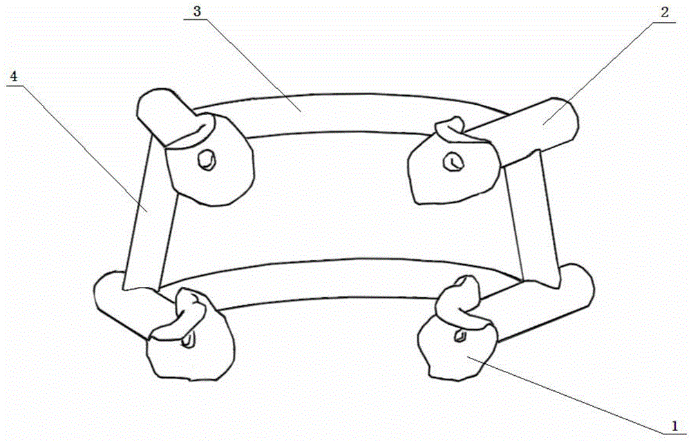 A personalized navigation template for assisting small incisions to insert pedicle screws and its manufacturing method