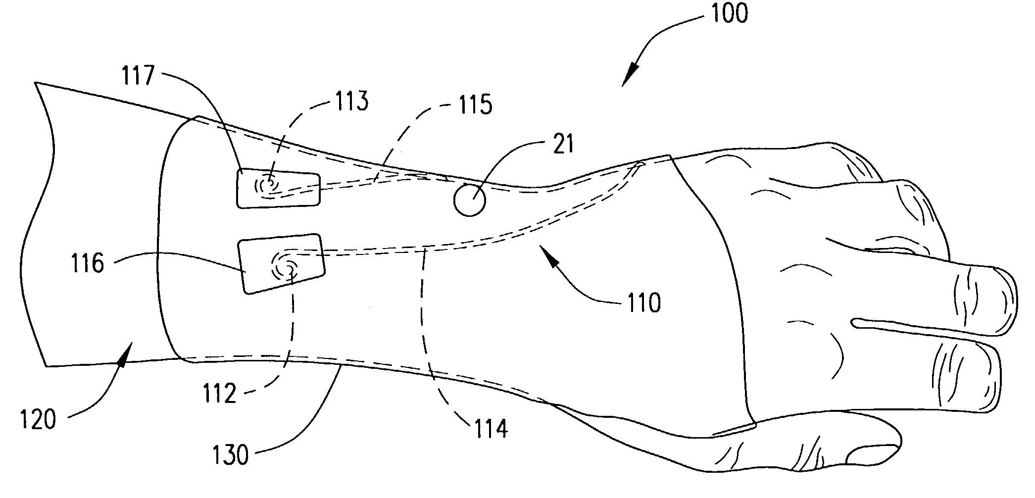 Co-dynamic adjustable orthotic appliance for carpal tunnel syndrome