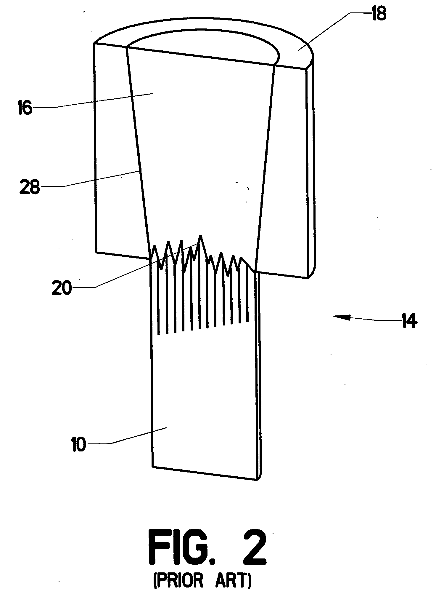 Stress redistributing cable termination