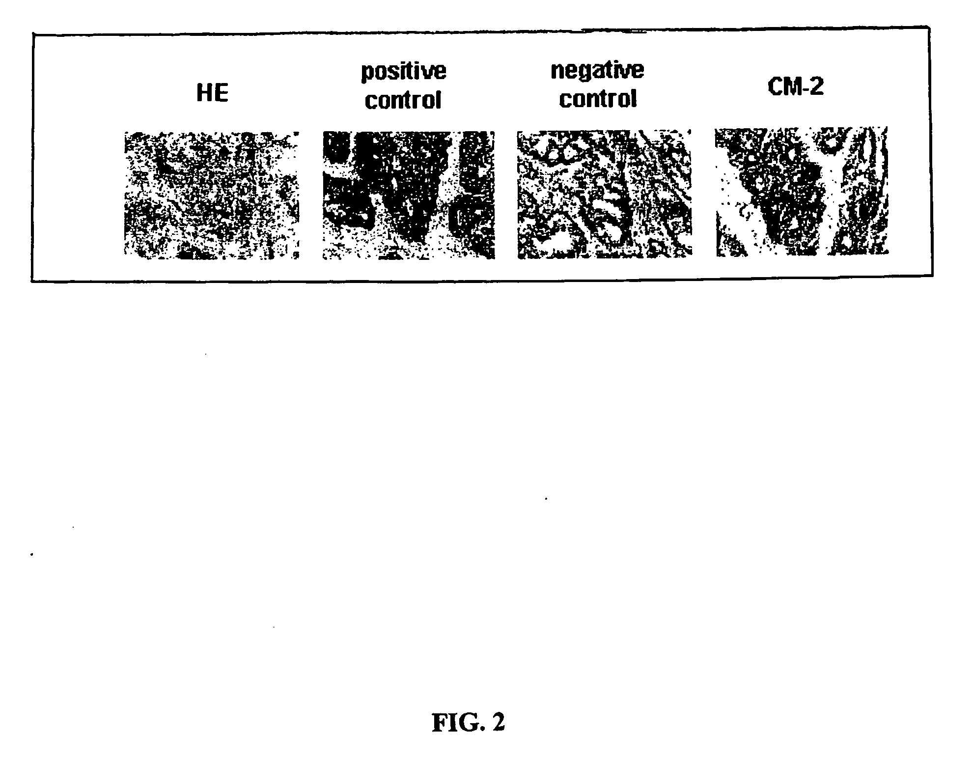 Neoplasm specific antibodies and uses thereof