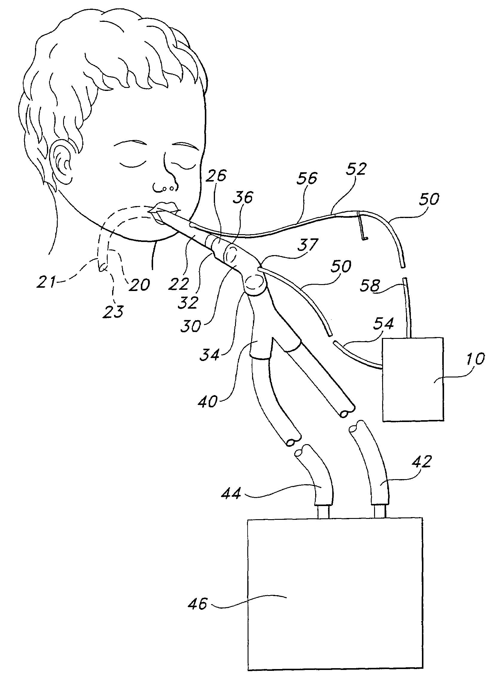 Endotracheal tube pressure monitoring system and method of controlling same